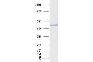 Aldehyde Dehydrogenase 3 Family, Member A1 (ALDH3A1) (Transcript Variant 2) protein (Myc-DYKDDDDK Tag)