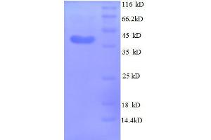 SDS-PAGE (SDS) image for Midkine (Neurite Growth-Promoting Factor 2) (MDK) (AA 21-143), (full length) protein (GST tag) (ABIN1047388)