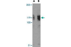Western blot analysis of FYB in K-562 cell lysate with FYB polyclonal antibody  at (A) 0.