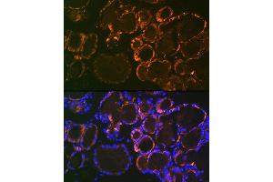 Immunofluorescence analysis of mouse thyroid using Parathyroid Hormone (PTH) (PTH) Rabbit mAb (ABIN7269175) at dilution of 1:100 (40x lens). (PTH 抗体)