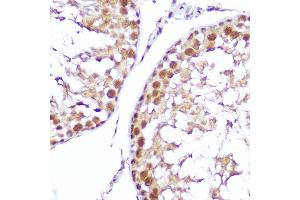 Immunohistochemistry of paraffin-embedded mouse testis using SMOX Rabbit pAb (ABIN6132875, ABIN6148142, ABIN6148143 and ABIN6215369) at dilution of 1:100 (40x lens). (SMOX 抗体  (AA 1-200))
