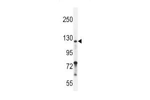 Neuropilin-2 Antibody (C-term ) (ABIN655525 and ABIN2845038) western blot analysis in ZR-75-1 cell line lysates (35 μg/lane). (NRP2 抗体  (C-Term))