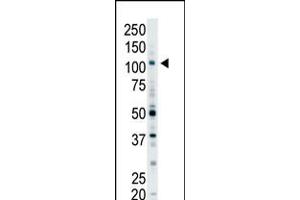 Antibody is used in Western blot to detect EPS15R in Y79 cell lysate. (EPS15 抗体  (N-Term))