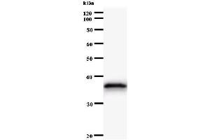 Western Blotting (WB) image for anti-AT Rich Interactive Domain 4A (RBP1-Like) (ARID4A) antibody (ABIN931104) (ARID4A 抗体)