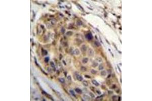 Immunohistochemistry (Paraffin-embedded Sections) (IHC (p)) image for anti-Slingshot Homolog 3 (SSH3) (AA 582-610), (C-Term) antibody (ABIN954955)