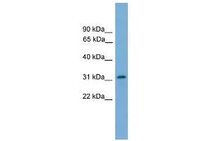 PIGL antibody used at 1 ug/ml to detect target protein. (PIGL 抗体  (N-Term))