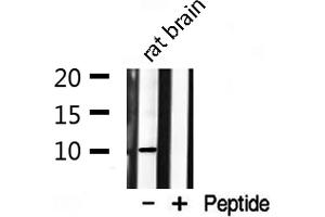Western blot analysis on rat brain lysate using S100 A1 Antibody (S100A1 抗体  (N-Term))