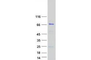 Western Blotting (WB) image for Cytoskeleton Associated Protein 2 (CKAP2) (Transcript Variant 1) protein (Myc-DYKDDDDK Tag) (ABIN2714207)