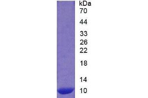 SDS-PAGE analysis of Human S100A12 Protein. (S100A12 蛋白)