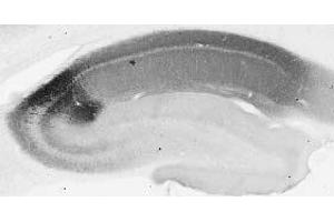 Adult rat hippocampus immunohistochemistry. (RGS14 抗体  (AA 1-544))