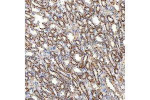 IHC analysis of SLC20A1 using anti-SLC20A1 antibody (ABIN7602463).