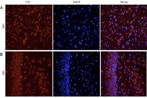 ABIN5539917 (5ug/ml) staining of paraffin embedded Rat Cerebral Cortex (A) and Rat Hippocampus (B), CRY-staining with DAPI nuclear counter stain in blue.