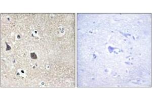 Immunohistochemistry (IHC) image for anti-Midline 1 (MID1) (AA 71-120) antibody (ABIN2889316) (MID1 抗体  (AA 71-120))