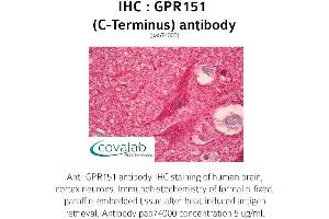 Image no. 1 for anti-G Protein-Coupled Receptor 151 (GPR151) antibody (ABIN1734968) (GPR151 抗体)