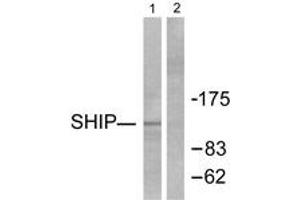 Western blot analysis of extracts from HuvEc cells, using SHIP1 Antibody. (INPP5D 抗体  (AA 1140-1189))