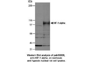 Image no. 2 for anti-Hypoxia Inducible Factor 1, alpha Subunit (Basic Helix-Loop-Helix Transcription Factor) (HIF1A) (AA 432-528) antibody (ABIN363317) (HIF1A 抗体  (AA 432-528))