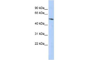 WB Suggested Anti-BCL6B Antibody Titration:  0. (BCL6B 抗体  (Middle Region))