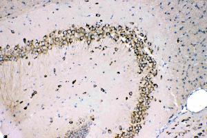 MPS1 was detected in paraffin-embedded sections of mouse brain tissues using rabbit anti- MPS1 Antigen Affinity purified polyclonal antibody (Catalog # ) at 1 µg/mL. (RPS27 抗体  (AA 2-84))