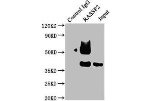 Immunoprecipitating RASSF2 in Raji whole cell lysate Lane 1: Rabbit control IgG instead of ABIN7167126 in Raji whole cell lysate. (RASSF2 抗体  (AA 69-326))