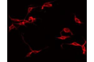 ABIN6267312 staining Hela by IF/ICC. (LCK 抗体  (pTyr505))