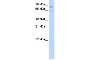 WB Suggested Anti-F13B Antibody Titration:  0. (F13B 抗体  (Middle Region))