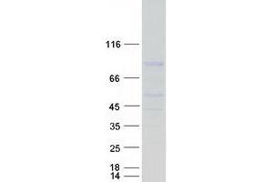 Validation with Western Blot