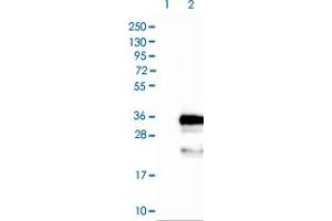 Western blot analysis of Lane 1: Negative control (vector only transfected HEK293T lysate) Lane 2: Over-expression lysate (Co-expressed with a C-terminal myc-DDK tag (~3. (FBXO44 抗体)