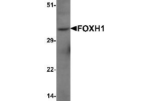 Western Blotting (WB) image for anti-Forkhead Box H1 (FOXH1) (N-Term) antibody (ABIN1077399) (FOXH1 抗体  (N-Term))