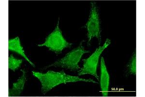 Immunofluorescence of monoclonal antibody to TBCC on HeLa cell. (TBCC 抗体  (AA 1-346))