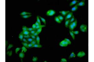 Immunofluorescence staining of HepG2 cells with ABIN7176505 at 1:133, counter-stained with DAPI. (ZNF73 抗体  (AA 218-286))