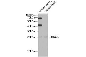 Western blot analysis of extracts of various cell lines, using HOXB7 antibody (ABIN6128065, ABIN6141944, ABIN6141945 and ABIN6222665) at 1:1000 dilution. (HOXB7 抗体  (AA 1-120))