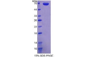 SDS-PAGE analysis of Human WNT2B Protein. (WNT2B 蛋白)
