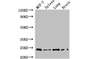 Western Blot Positive WB detected in: MCF-7 whole cell lysate, Mouse spleen tissue, Mouse lung tissue, Mouse brain tissue All lanes: RAB25 antibody at 4 μg/mL Secondary Goat polyclonal to rabbit IgG at 1/50000 dilution Predicted band size: 24 kDa Observed band size: 24 kDa (RAB25 抗体  (AA 1-210))