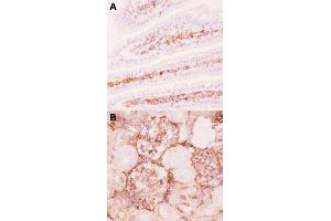 Immunohistochemical staining (Frozen sections) of mouse intestine tissue (A) and rat kidney tissue (B) with ABCB1 polyclonal antibody  under 0. (ABCB1 抗体  (AA 621-650))