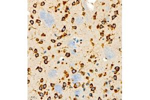 Immunohistochemistry of paraffin embedded rat brain using P4H (ABIN7074215) at dilution of 1:700 (400x lens) (HIF Prolyl Hydroxylase 抗体)