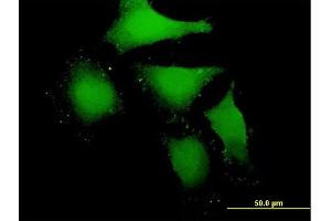 Immunofluorescence of purified MaxPab antibody to MBIP on HeLa cell. (MBIP 抗体  (AA 1-343))