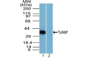 Image no. 1 for anti-Thioredoxin Interacting Protein (TXNIP) (AA 100-150) antibody (ABIN960393) (TXNIP 抗体  (AA 100-150))