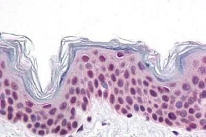 Human Skin: Formalin-Fixed, Paraffin-Embedded (FFPE) (CDC27 抗体  (C-Term))