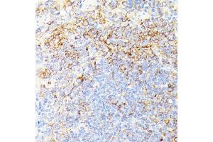Immunohistochemistry of paraffin-embedded mouse spleen using RIPK1/RIP antibody (ABIN6132596, ABIN6146959, ABIN6146960 and ABIN6223282) at dilution of 1:100 (40x lens).