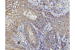 IHC analysis of CD147/Emmprin using anti-CD147/Emmprin antibody (ABIN7599997). (CD147 抗体  (AA 138-323))