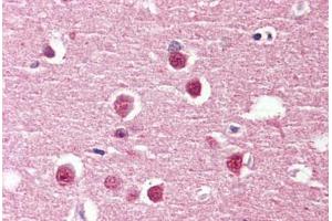 Brain, cortex, Human: Formalin-Fixed, Paraffin-Embedded (FFPE) (ADGRV1 / GPR98 抗体  (Internal Region))