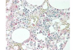 Human Bone Marrow: Formalin-Fixed, Paraffin-Embedded (FFPE). (Epiregulin 抗体  (AA 30-169) (Biotin))