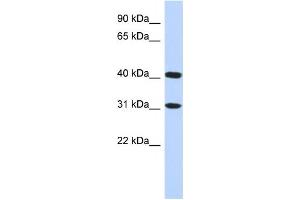 Western Blotting (WB) image for anti-Family with Sequence Similarity 46, Member D (FAM46D) antibody (ABIN2459624) (FAM46D 抗体)