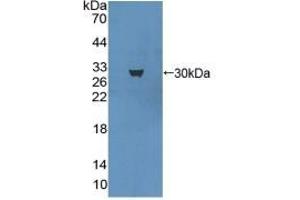 Detection of Recombinant MAP1A, Mouse using Polyclonal Antibody to Microtubule Associated Protein 1A (MAP1A) (MAP1A 抗体  (AA 2552-2759))