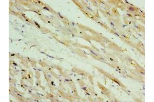 Immunohistochemistry of paraffin-embedded human heart tissue using ABIN7170926 at dilution of 1:100 (OXCT1 抗体  (AA 261-520))