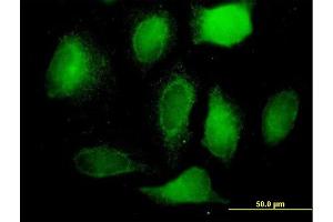 Immunofluorescence of purified MaxPab antibody to BCAP31 on HeLa cell. (BCAP31 抗体  (AA 1-246))