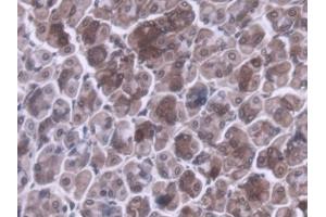DAB staining on IHC-P; Samples: Mouse Stomach Tissue (MRPL1 抗体  (AA 143-336))