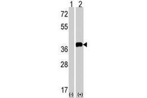 Western blot analysis of SNAI1 (arrow) using SNAI1 polyclonal antibody . (SNAIL 抗体  (N-Term))