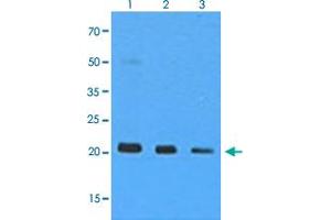 Western Blot analysis of 293T cell lysate (Lane 1: 1:500, Lane 2: 1:1000 and Lane 3: 1:5000) with NRAS monoclonal antibody, clone AT2G9 . (GTPase NRas 抗体)