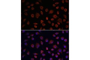Immunofluorescence analysis of L929 cells using ULK1 antibody (ABIN6134005, ABIN6149921, ABIN6149922 and ABIN6224624) at dilution of 1:100. (ULK1 抗体  (AA 400-499))